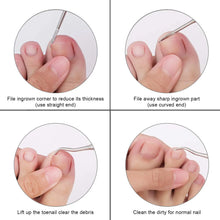 Carregar imagem no visualizador da galeria, Cortador de Unhas do Dedo do Pé para Unhas Encravadas ou Grossas. Aparador de Unhas Profissional
